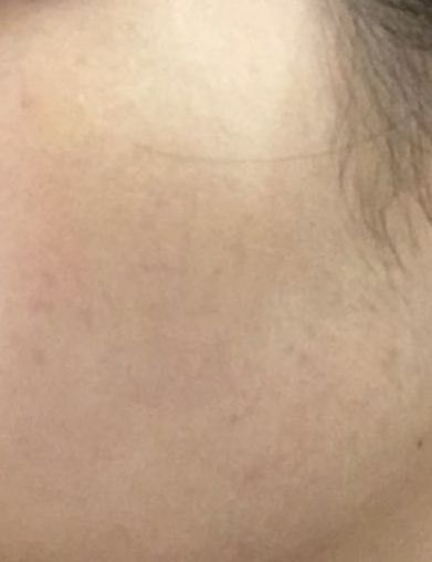 敏感肌适合的洗面奶乳液,适合红血丝皮肤的乳液