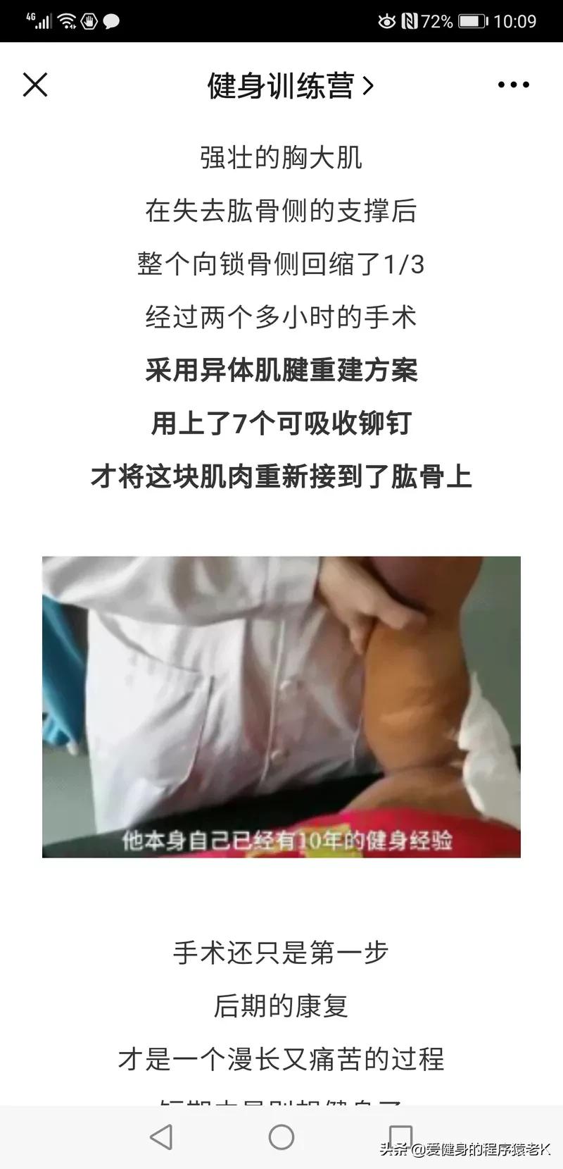 胸肌撕裂瞬间健身事故,国外著名健身大神胸肌撕裂