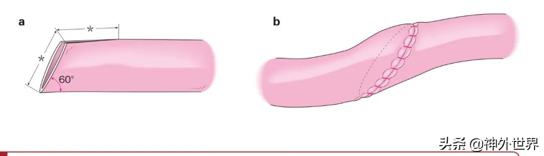 日本治神经损伤特效药,脑动脉炎症状与治疗