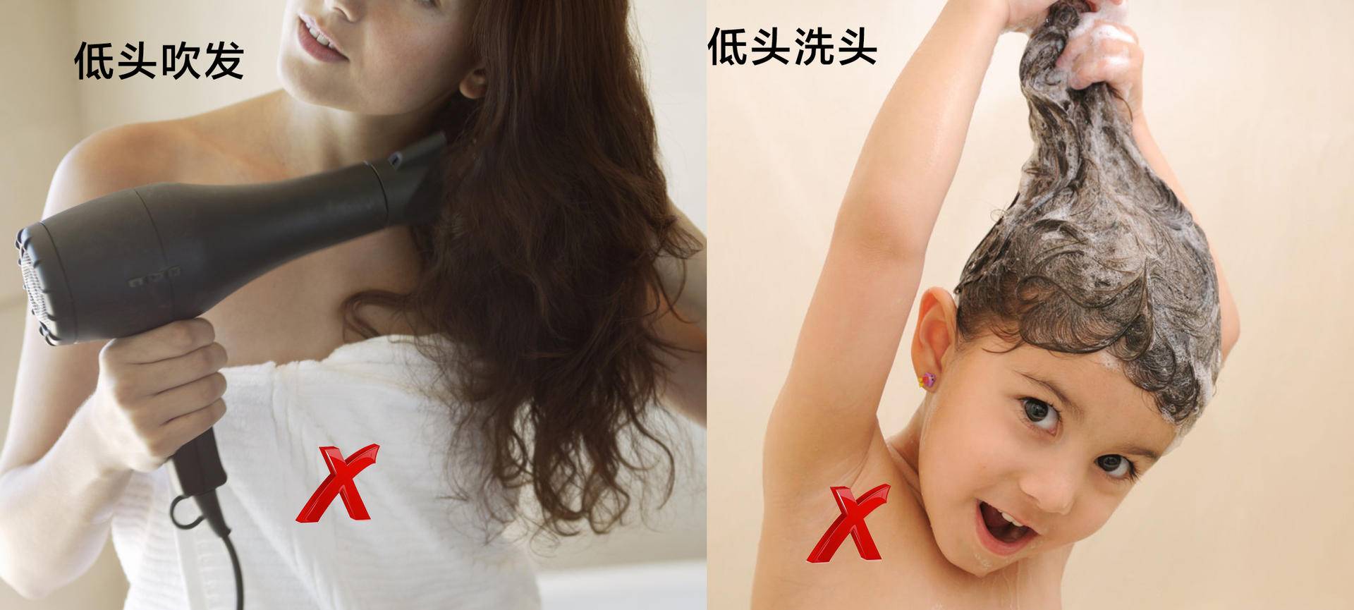 如何消除眼角皱纹和抬头纹的方法,消除川字纹和抬头纹最有效的方法