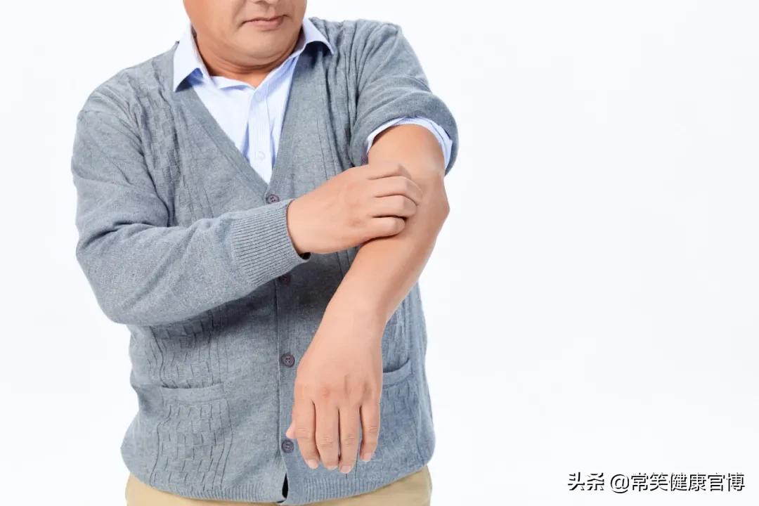 老年人湿疹反复发作的原因,小儿湿疹反复发作怎么回事