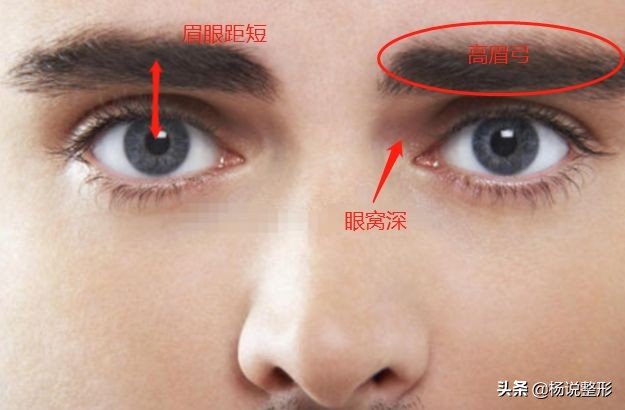 整形医生科普割双眼皮必看攻略,割双眼皮一定好看吗