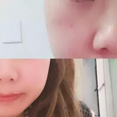 天然速效多功能爽肤水,提亮肤色清爽型爽肤水