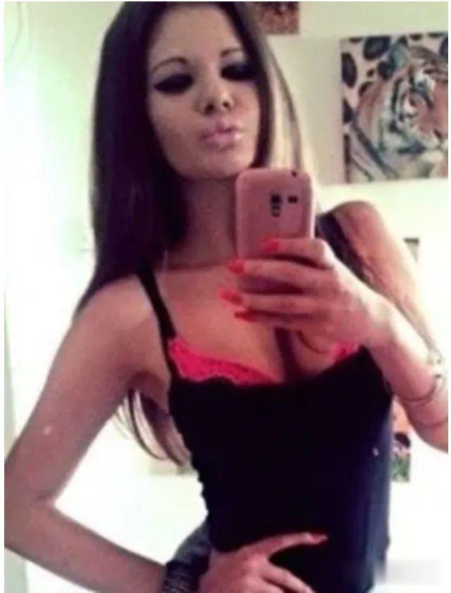 20次整容成功的女人,22岁女人做20次丰唇手术