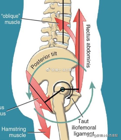 【体态矫正】骨盆后倾的形成原因与矫正训练