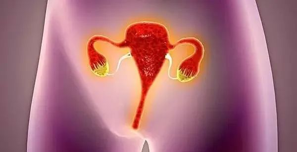 盆腔积液11mm怀孕了胎儿有影响吗,怀孕有盆腔积液会流褐色分泌物吗