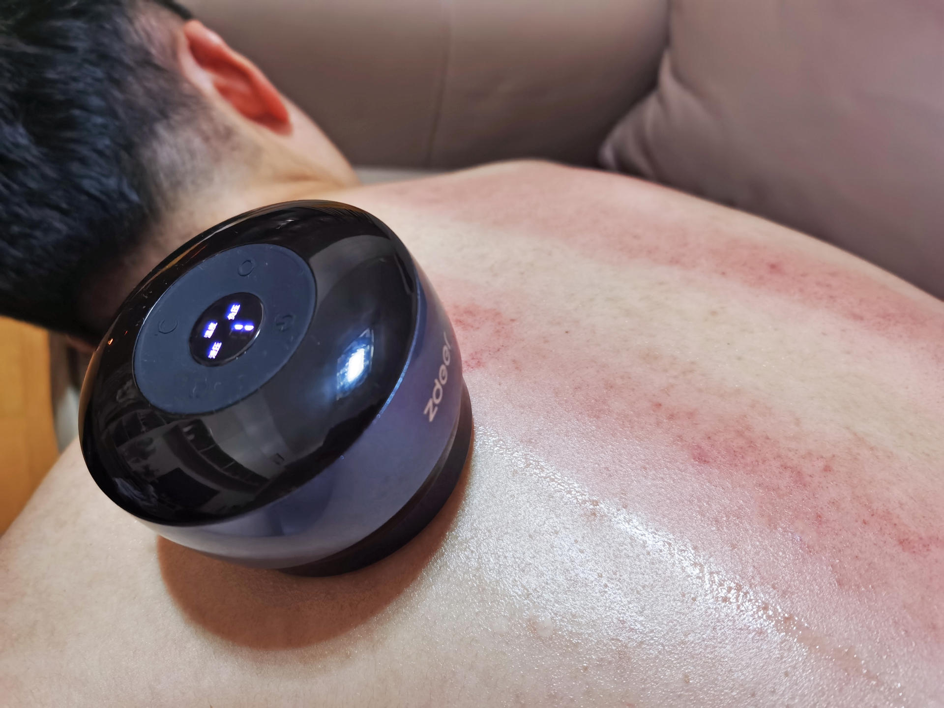 养生馆用刮痧走罐按摩器,走罐刮痧按摩器测评