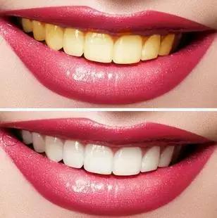 一口黄牙能洗白吗,一口黄牙毁了一张脸