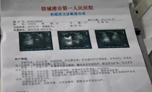 如何看懂胃镜活检报告,胃镜病理活检报告一般需几天