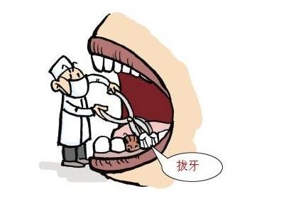 拔牙后出血的原因及处理办法,拔牙后出血严重会导致什么症状