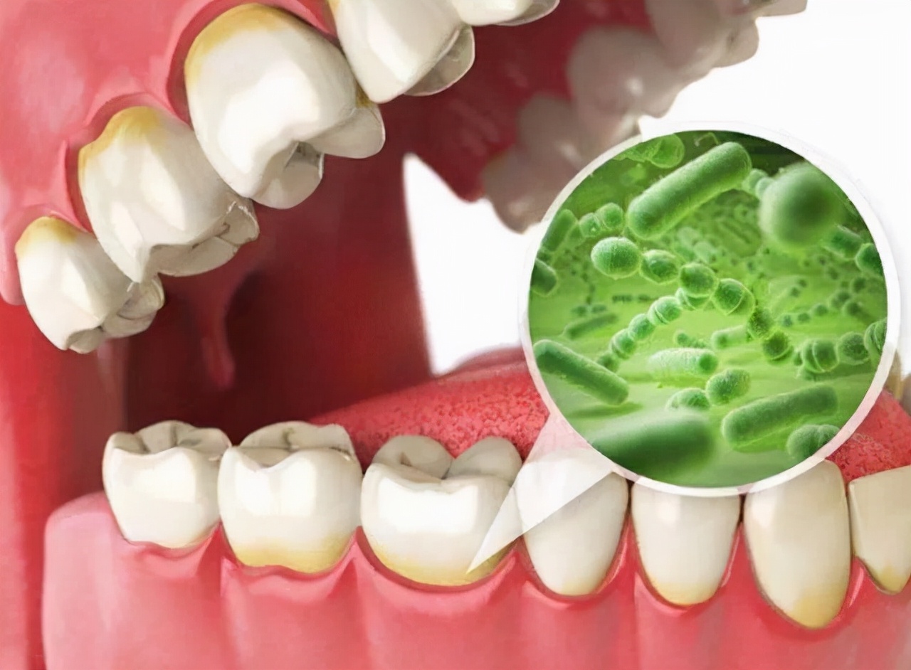 口臭20多年了怎样彻底根除,口臭很尴尬9个方法轻松消除口臭