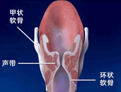 别大意！娃嗓子哭哑了，这种情况可能要手术