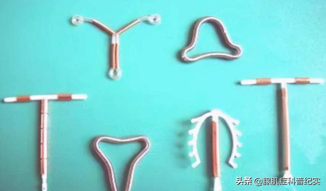 取下节育环会不会减轻腺肌症疼呢,宫内节育环可以治痛经吗