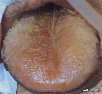 最实用的舌诊图六大舌象,舌诊深入学习书