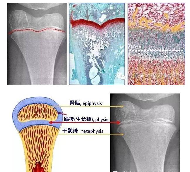 儿童骨科和成人骨科有什么区别,小儿骨科辟谣