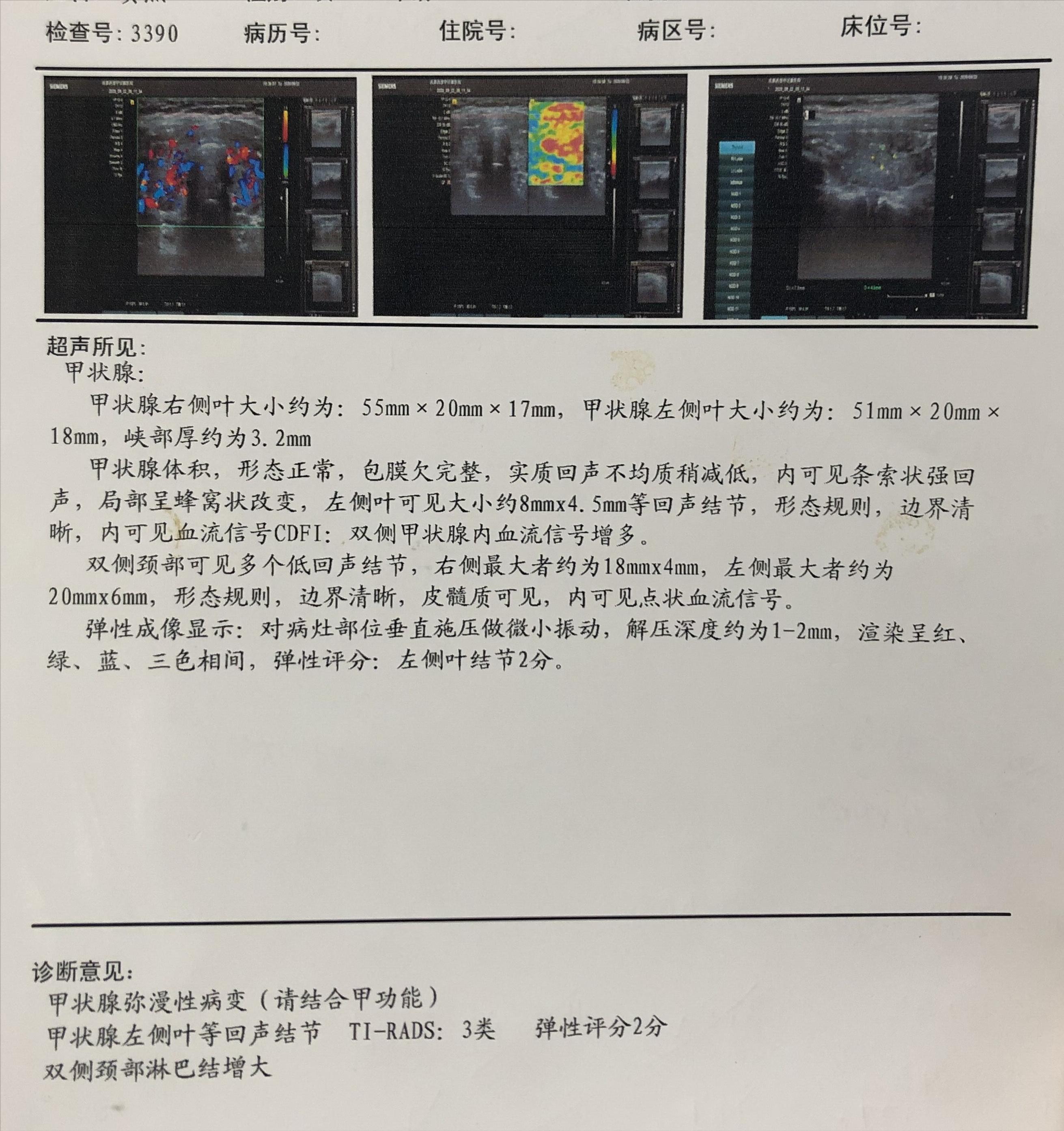 甲功的抗体超过1000是什么意思,甲功抗体高2000怎么办