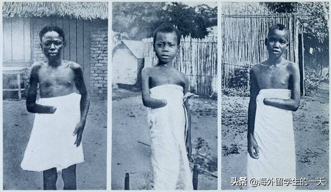 非洲大陆上的黑暗战争