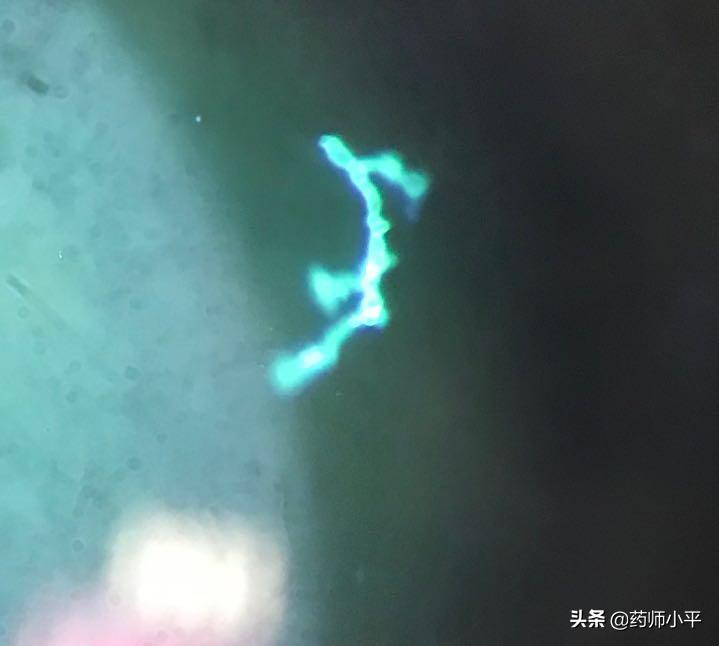 美国发现罕见真菌感染病例,感染100天后死亡率