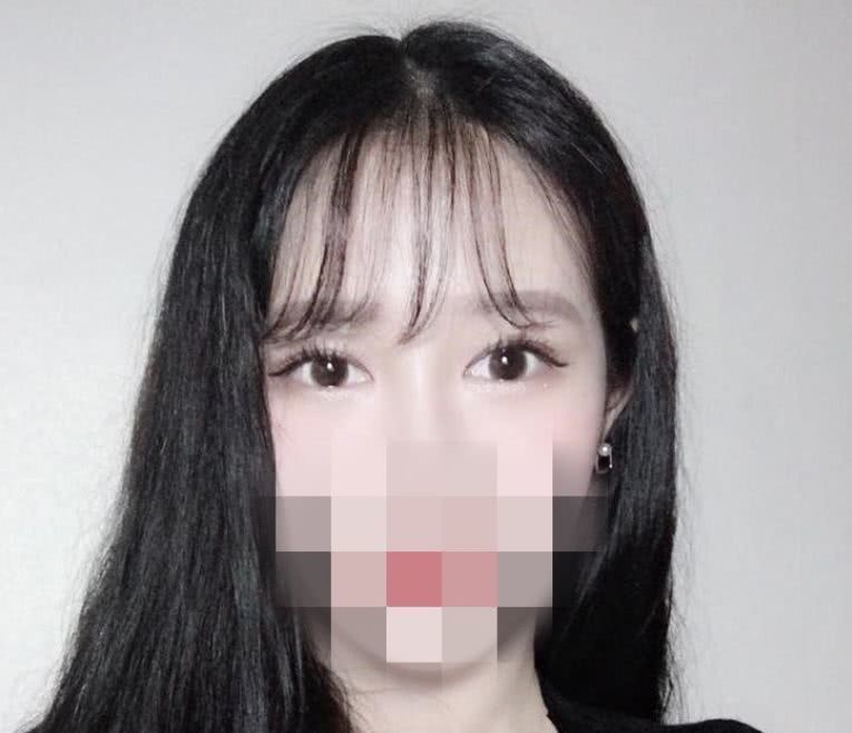 去皮去脂双眼皮恢复大概多长时间,全切双眼皮去皮去脂完全恢复视频