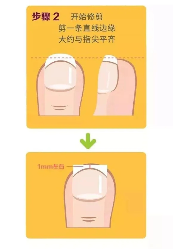 指甲老往肉里长化脓,指甲为什么一直往肉里长