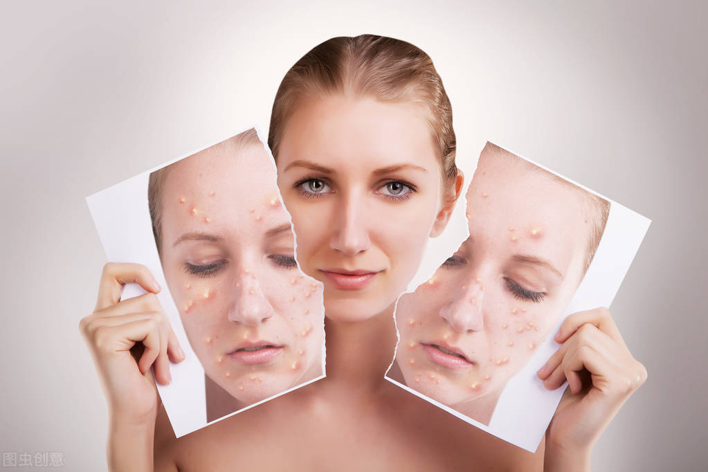 快速祛痘痘的方法要有效,如何祛痘痘最快方法简单