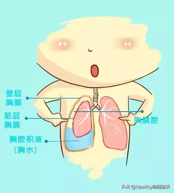 喘不上气的漫画,喘不过气的漫画