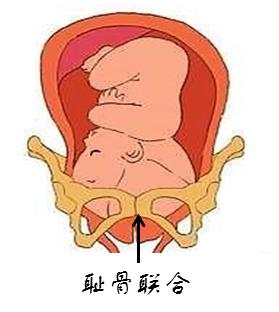 怀孕骨头痛是什么原因,怀孕胸下面骨头疼是怎么回事啊