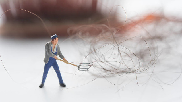 头皮发痒掉头发是什么原因引起的,女性掉头发失眠是什么原因引起的