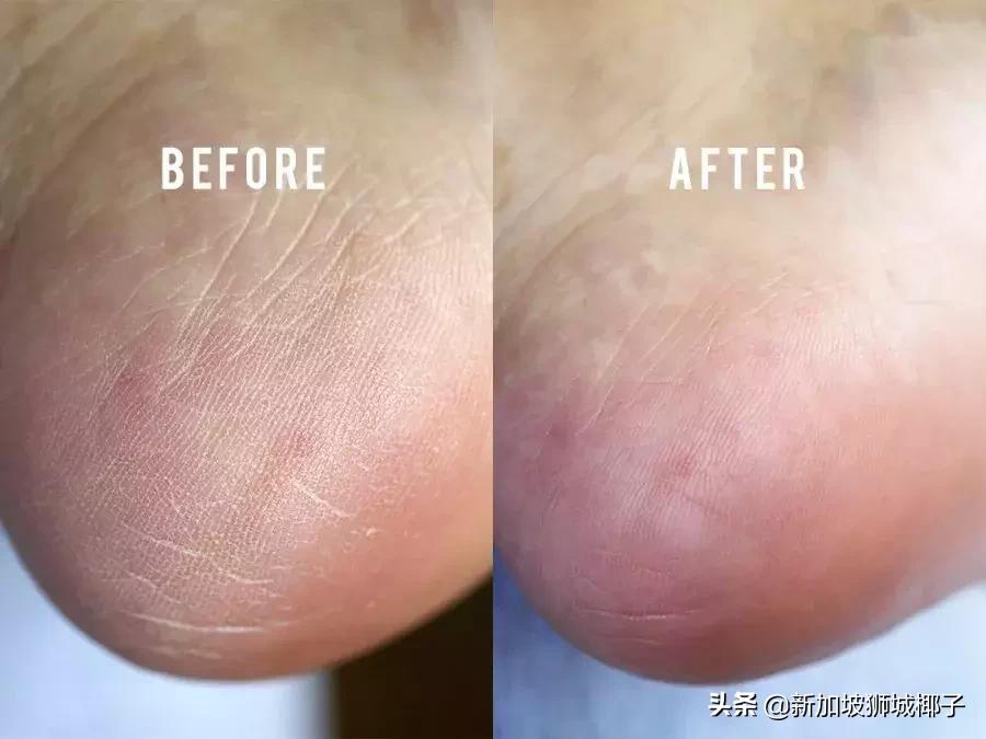 新西兰药妆店必买产品,新加坡日本药妆