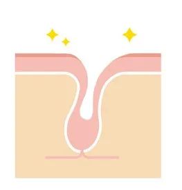 十滴水碘伏甲硝唑治黑头,十滴水加碘伏祛黑头用法