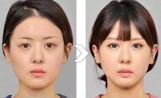 你的“包子脸”,或许我能帮你消灭它?!