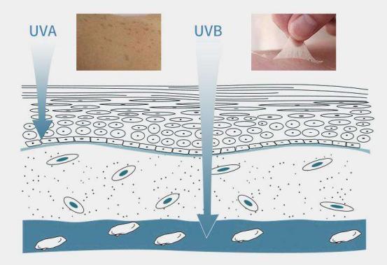 军训后晒黑了怎么快速变白高中生,军训晒黑怎么变白最快最有效脸部