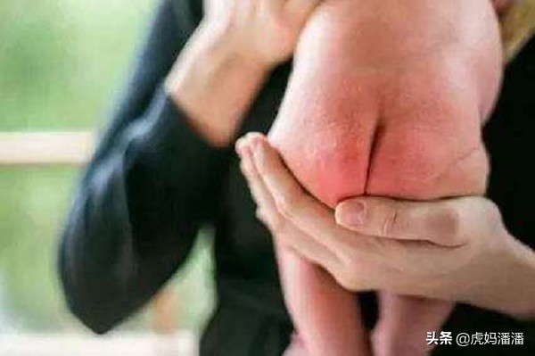 宝宝红屁屁洗屁屁方法,婴儿洗屁屁和洗脚有必要分开么