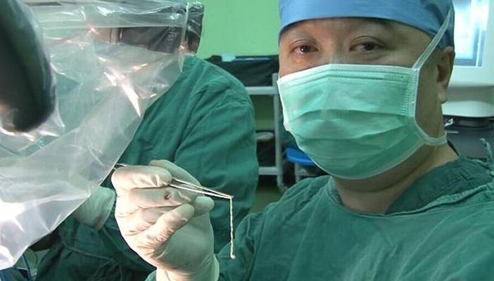 女子被福寿鱼刺戳伤手指险截肢,男子被鱼刺扎手竟需截肢才能保命