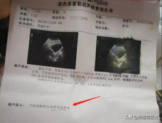 月经紊乱的症状表现45岁,更年期月经紊乱病例