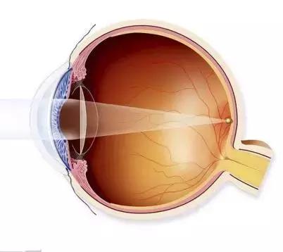 眼前一直有蚊子是什么病,眼前总有蚊子飞怎么治呀