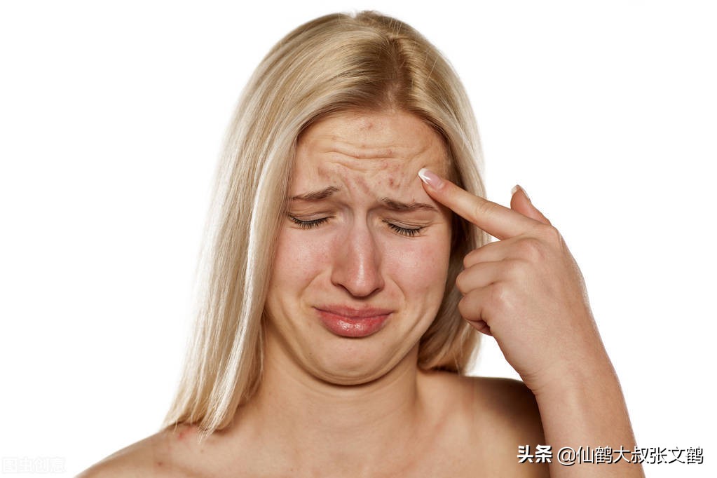 国际痘痘指南,痘痘等级划分标准图