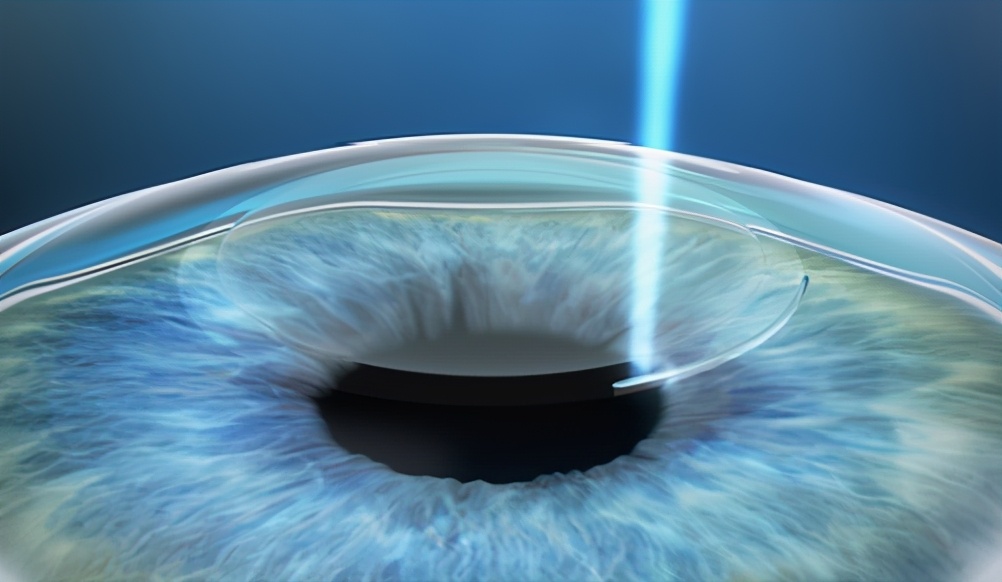 全飞秒手术到底疼不疼,全飞秒近视眼手术危害