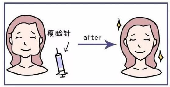 瘦脸针怎么避开腮腺,瘦脸针僵硬感怎么解决