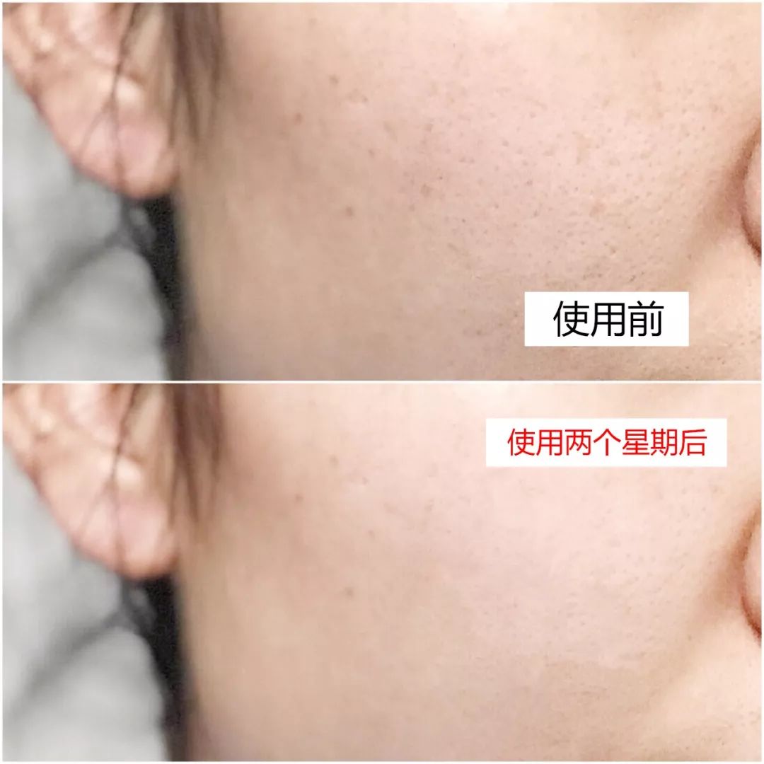 好用的美白面膜推荐平价,好用又便宜的美白面膜推荐