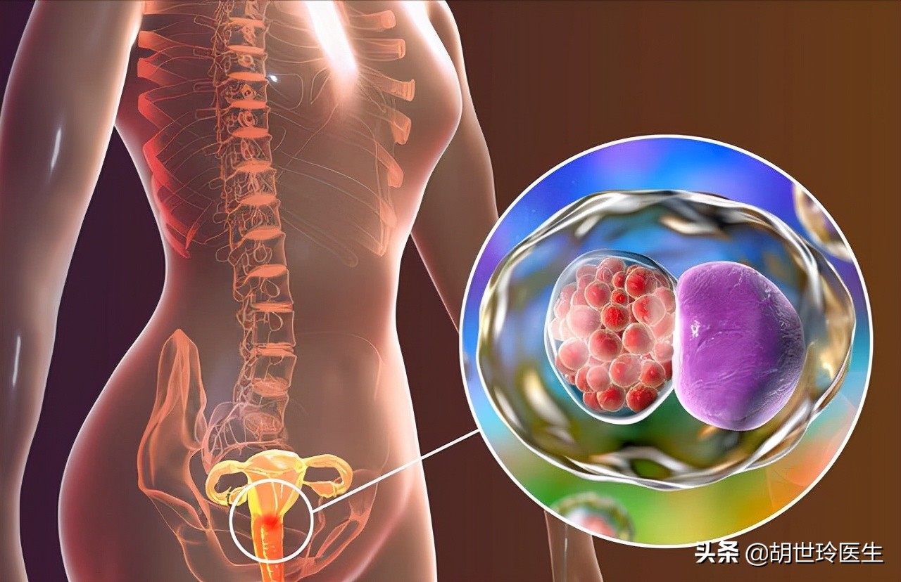 宫颈炎会怎么治疗,宫颈炎性疾病该怎么办