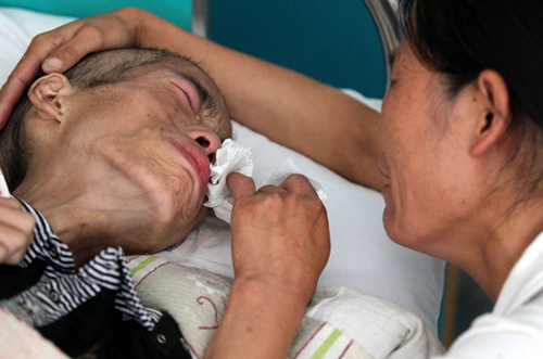 癌症晚期无药可治该怎么办,癌症晚期没钱吃药