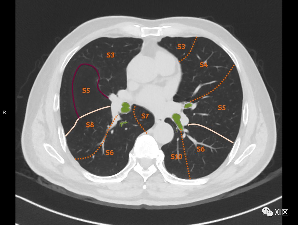 如此详细的肺部影像解剖，有点儿酷