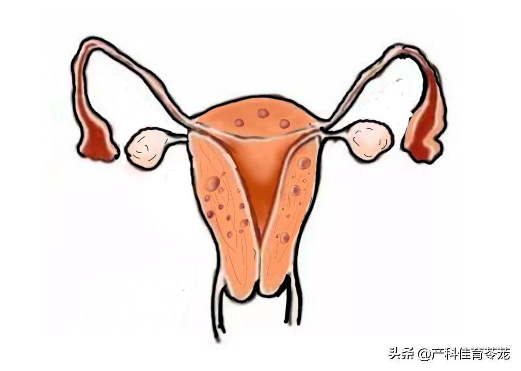 月经不调延后如何调理月经量少,月经不调不正常量少