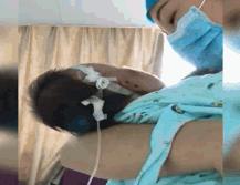 婴儿腰椎穿刺两次没成功,宝宝腰穿刺失败