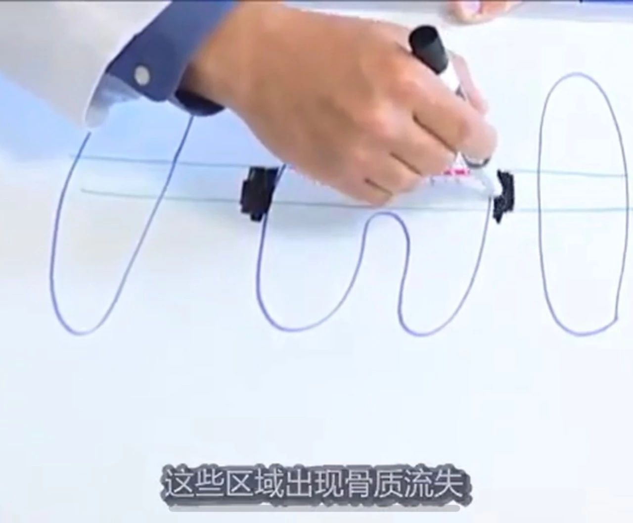 猫有牙结石牙龈红肿怎么治疗,猫已经有牙结石了怎么办