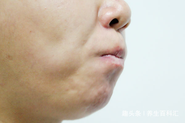 口臭是社交“尴尬癌”，教你简单几招，帮你自测口臭程度