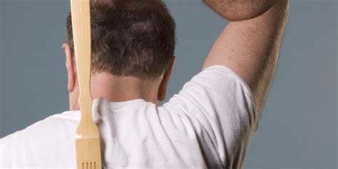 银屑病秋冬期症状加重怎么护理,银屑病皮肤瘙痒脱屑怎么办