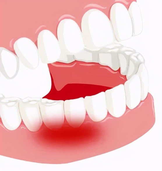 没有征兆而突发心梗有多可怕,哪些地方疼会是心梗的前兆