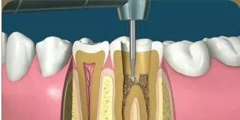 怎么样看牙最省钱,看牙嫌贵这个省钱机会千万别错过